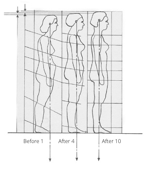 10-series progression